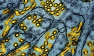Bird flu: Louisiana patient is first severe case and California declares emergency