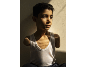 Portrait of a wounded Palestinian boy wins Press Photo of the Year